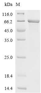 Acetylcholinesterase Protein, Human, Recombinant (His)