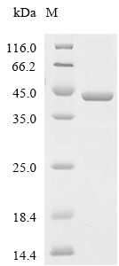 Hemoglobin subunit delta/HBD Protein, Human, Recombinant (GST & His)