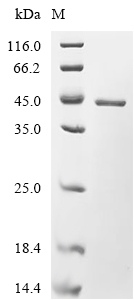 HAT1 Protein, Human, Recombinant (His)