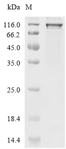 PYGB Protein, Human, Recombinant (GST)