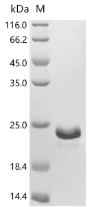 FABP4 Protein, Mouse, Recombinant (E. coli, His)