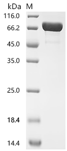 DT3C Protein, Recombinant (His)