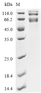 PARP1 Protein, Human, Recombinant (HEK293, His)