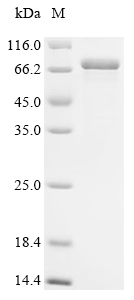 YTHDF2 Protein, Human, Recombinant (His)