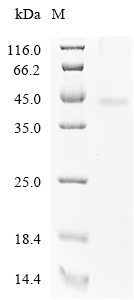 CMKLR1 Protein, Human, Recombinant (C-His)