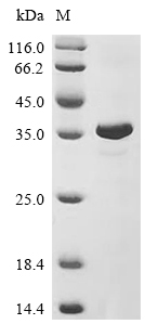 ADAR Protein, Human, Recombinant (His & SUMO)