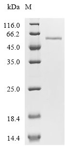 ADAM12 Protein, Mouse, Recombinant (His & Myc)