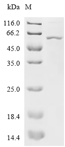 AP2M1 Protein, Human, Recombinant (His)
