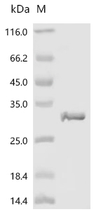 Diphtheria toxin Protein, Corynephage omega, Recombinant (His & Myc)