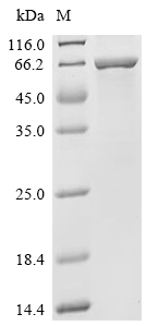 FTO Protein, Human, Recombinant (His & Myc)