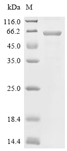 BoNT/E Protein, Clostridium butyricum, Recombinant (His & SUMO)