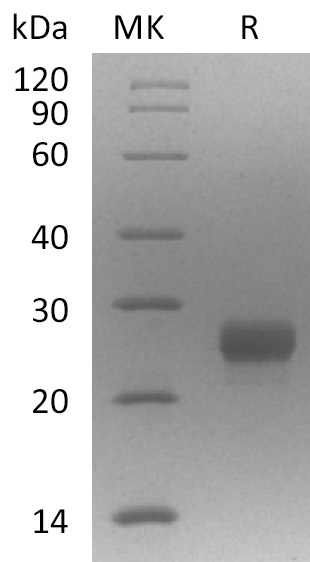 RANKL/TNFSF11/CD254 Protein, Mouse, Recombinant (Flag & His)