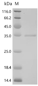 PYCR1 Protein, Human, Recombinant (His & SUMO)