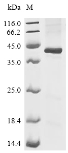 STEAP1 Protein, Human, Recombinant (His)