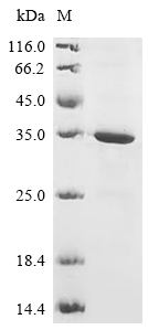 BDH1 Protein, Human, Recombinant (His)