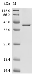 BDH1 Protein, Human, Recombinant (C-His)