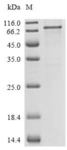 ITGB7 Protein, Human, Recombinant (His)