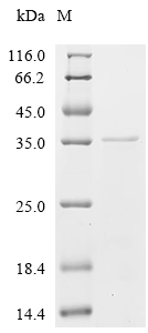 HIF1A Protein, Human, Recombinant (His)