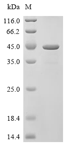 MMP-7 Protein, Rat, Recombinant (GST)