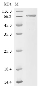 PADI3 Protein, Human, Recombinant (His)