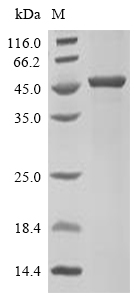 PLA2G15 Protein, Human, Recombinant (His)