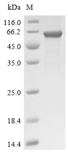 TRIM21 Protein, Mouse, Recombinant (E. coli, His)