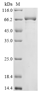 ZC3H12A Protein, Human, Recombinant (His)
