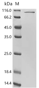 STAT3 Protein, Human, Recombinant (aa 1-770, His)