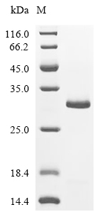 Human Papilloma Virus type 52 (HPV 52) Protein E7 (His & SUMO)