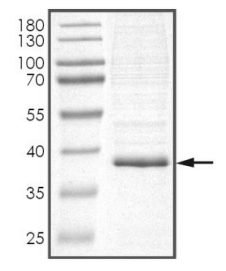 SIRT6 Protein, Human, Recombinant (His)