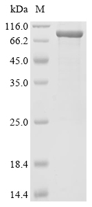TRIM9 Protein, Human, Recombinant (His & SUMO)