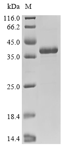 Neurofibromin/NF1 Protein, Human, Recombinant (His & Myc)