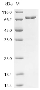 RORC Protein, Human, Recombinant (His & SUMO)