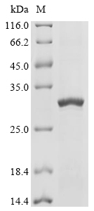 AHR Protein, Human, Recombinant (His)
