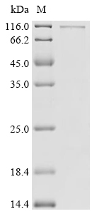 FBXW7 Protein, Human, Recombinant (His)
