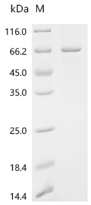 CYP11B2 Protein, Human, Recombinant (His & SUMO)