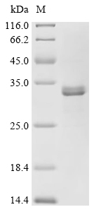 CELA3B Protein, Human, Recombinant (His)