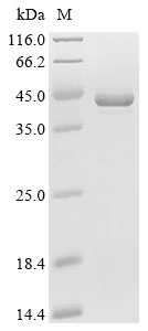 INMT Protein, Human, Recombinant (His & SUMO)