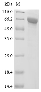 KRT2 Protein, Human, Recombinant (His & Myc)