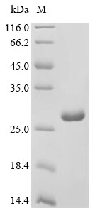RAC1 Protein, Human, Recombinant (E. coli, His)