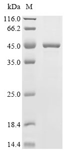 PARP11 Protein, Human, Recombinant (His)