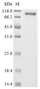 MMUT Protein, Human, Recombinant (His)