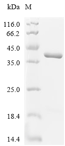 RAB5C Protein, Human, Recombinant (His & SUMO)