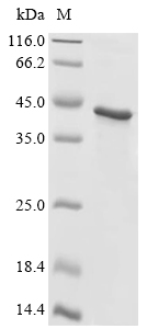 RPSA Protein, Human, Recombinant (His & Myc)