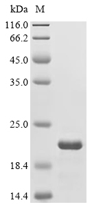 TRBC1 Protein, Human, Recombinant (His & Myc)