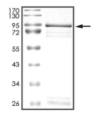 EGFR Protein, Human, Recombinant (aa 668-1210, GST)