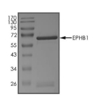 EphB1 Protein, Mouse, Recombinant (GST)
