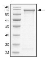 Beta-Catenin Protein, Human, Recombinant (GST)