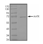 AATK Protein, Mouse, Recombinant (GST)