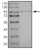 DGKG Protein, Human, Recombinant (aa 10-791, His)